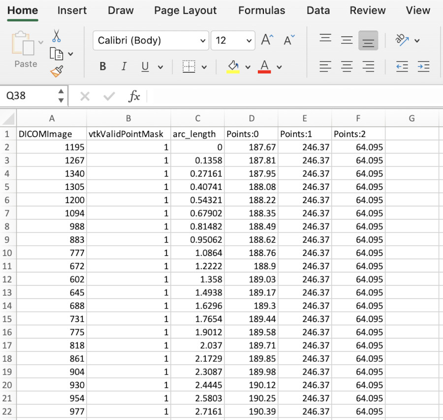 MRI CSV in Excel