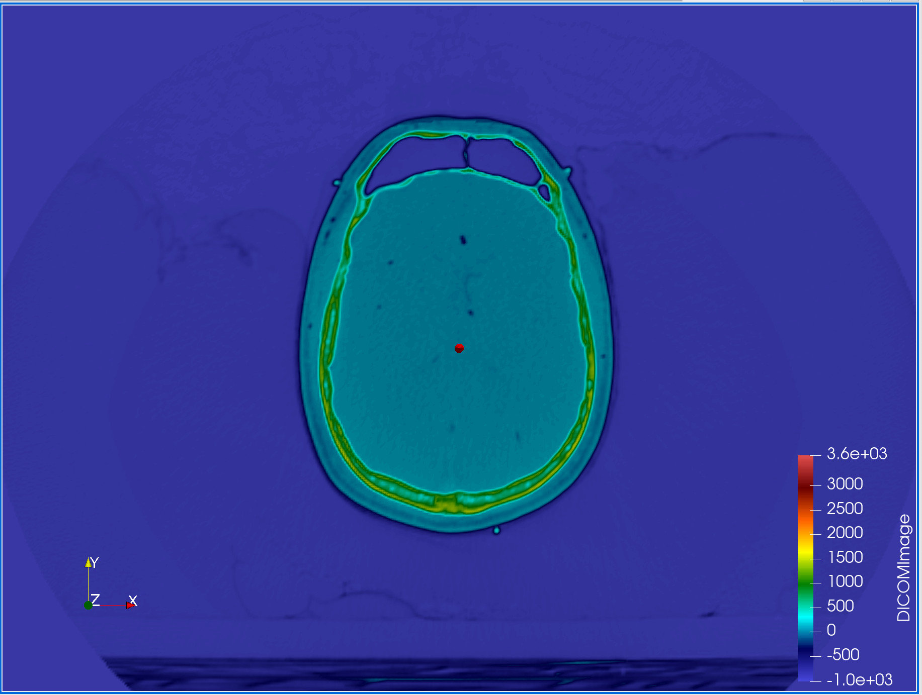 MRI slice main view top down