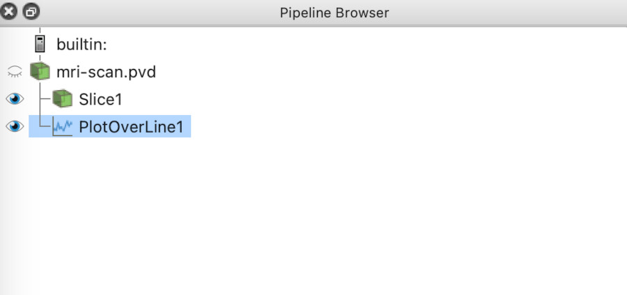 MRI plot over line pipeline browser